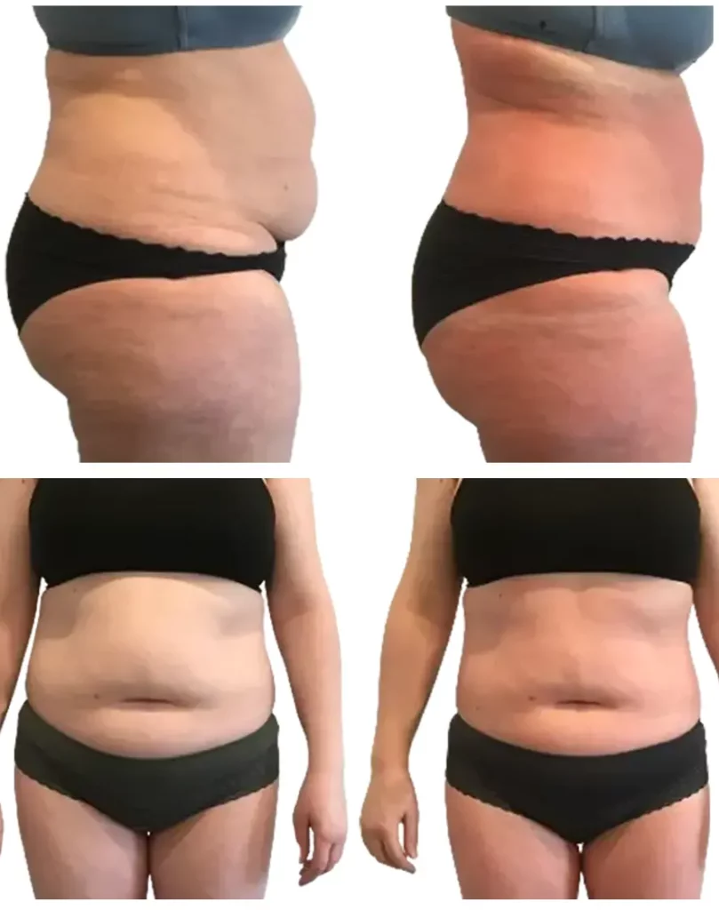BioSlimmming AvAp